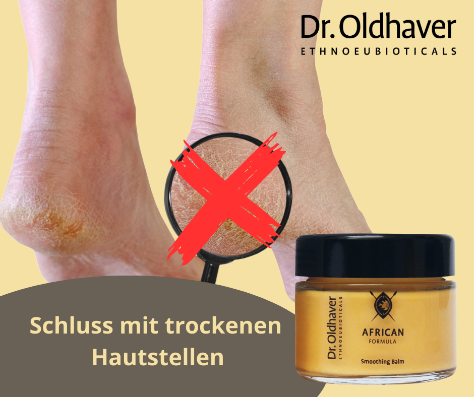 dr-oldhaver-smoothing-balm-f-r-trockene-hautstellen-50-ml image 6